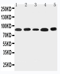 NOX5 Antibody - WB of NOX5 antibody. Lane 1: Rat Testis Tissue Lysate. Lane 2: Rat Spleen Tissue Lysate. Lane 3: Rat Ovary Tissue Lysate. Lane 4: HELA Cell Lysate. Lane 5: SKOV-3 Cell Lysate.