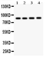 NOX5 Antibody - Anti-NOX5 antibody, Western blotting All lanes: Anti at 0.5ug/ml Lane 1: 22RV1 Whole Cell Lysate at 40ugLane 2: PANC Whole Cell Lysate at 40ugLane 3: HELA Whole Cell Lysate at 40ugLane 4: SKOV Whole Cell Lysate at 40ugPredicted bind size: 86KD Observed bind size: 86KD