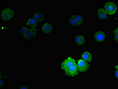 NOX5 Antibody - Immunofluorescent analysis of mcf-7 cells diluted at 1:100 and Alexa Fluor 488-congugated AffiniPure Goat Anti-Rabbit IgG(H+L)