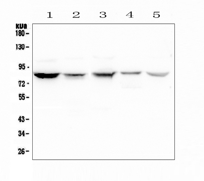 NOX5 Antibody - Western blot analysis of NOX5 using anti-NOX5 antibody. Electrophoresis was performed on a 5-20% SDS-PAGE gel at 70V (Stacking gel) / 90V (Resolving gel) for 2-3 hours. The sample well of each lane was loaded with 50ug of sample under reducing conditions. Lane 1: human Hela whole cell lysate,Lane 2: human placenta tissue lysates,Lane 3: human SGC-7901 whole cell lysate,Lane 4: human Jurkat whole cell lysate,Lane 5: human THP-1 whole cell lysate. After Electrophoresis, proteins were transferred to a Nitrocellulose membrane at 150mA for 50-90 minutes. Blocked the membrane with 5% Non-fat Milk/ TBS for 1.5 hour at RT. The membrane was incubated with rabbit anti-NOX5 antigen affinity purified polyclonal antibody at 0.5 µg/mL overnight at 4°C, then washed with TBS-0.1% Tween 3 times with 5 minutes each and probed with a goat anti-rabbit IgG-HRP secondary antibody at a dilution of 1:10000 for 1.5 hour at RT. The signal is developed using an Enhanced Chemiluminescent detection (ECL) kit with Tanon 5200 system. A specific band was detected for NOX5 at approximately 86KD. The expected band size for NOX5 is at 86KD.
