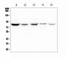 NOX5 Antibody - Western blot analysis of NOX5 using anti-NOX5 antibody. Electrophoresis was performed on a 5-20% SDS-PAGE gel at 70V (Stacking gel) / 90V (Resolving gel) for 2-3 hours. The sample well of each lane was loaded with 50ug of sample under reducing conditions. Lane 1: human Hela whole cell lysate,Lane 2: human placenta tissue lysates,Lane 3: human SGC-7901 whole cell lysate,Lane 4: human Jurkat whole cell lysate,Lane 5: human THP-1 whole cell lysate. After Electrophoresis, proteins were transferred to a Nitrocellulose membrane at 150mA for 50-90 minutes. Blocked the membrane with 5% Non-fat Milk/ TBS for 1.5 hour at RT. The membrane was incubated with rabbit anti-NOX5 antigen affinity purified polyclonal antibody at 0.5 µg/mL overnight at 4°C, then washed with TBS-0.1% Tween 3 times with 5 minutes each and probed with a goat anti-rabbit IgG-HRP secondary antibody at a dilution of 1:10000 for 1.5 hour at RT. The signal is developed using an Enhanced Chemiluminescent detection (ECL) kit with Tanon 5200 system. A specific band was detected for NOX5 at approximately 86KD. The expected band size for NOX5 is at 86KD.