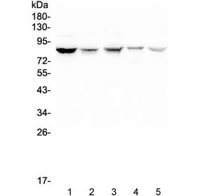 NOX5 Antibody - Western blot testing of human 1) HeLa, 2) placenta, 3) SCG-7901, 4) Jurkat and 5) THP-1 lysate with NOX5 antibody at 0.5ug/ml. Predicted molecular weight: ~86 kDa.
