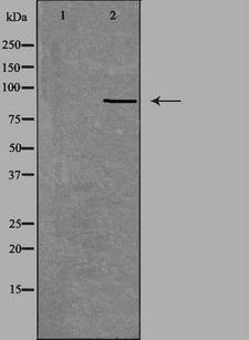 NOX5 Antibody - Western blot analysis of extracts of Jurkat cells using NOX5 antibody. The lane on the left is treated with the antigen-specific peptide.