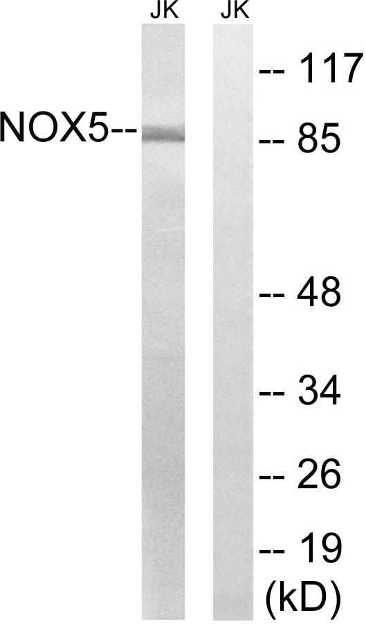 NOX5 Antibody - Western blot analysis of extracts from Jurkat cells, using NOX5 antibody.