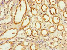 NOXA1 Antibody - Immunohistochemistry of paraffin-embedded human kidney tissue at dilution of 1:100