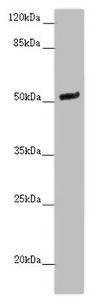 NOXA1 Antibody - Western blot All Lanes :NOXA1 antibody at 2 ug/ml+Mouse brain tissue Secondary Goat polyclonal to rabbit at 1/10000 dilution Predicted band size: 51,52,46 kDa Observed band size: 51 kDa