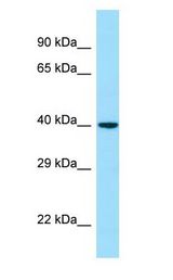NOXO1 Antibody - NOXO1 antibody Western Blot of Human Kidney.  This image was taken for the unconjugated form of this product. Other forms have not been tested.