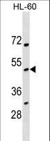 NOXO1 Antibody - NOXO1 Antibody western blot of HL-60 cell line lysates (35 ug/lane). The NOXO1 antibody detected the NOXO1 protein (arrow).