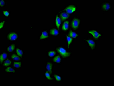NOXO1 Antibody - Immunofluorescence staining of Hela cells diluted at 1:66, counter-stained with DAPI. The cells were fixed in 4% formaldehyde, permeabilized using 0.2% Triton X-100 and blocked in 10% normal Goat Serum. The cells were then incubated with the antibody overnight at 4°C.The Secondary antibody was Alexa Fluor 488-congugated AffiniPure Goat Anti-Rabbit IgG (H+L).