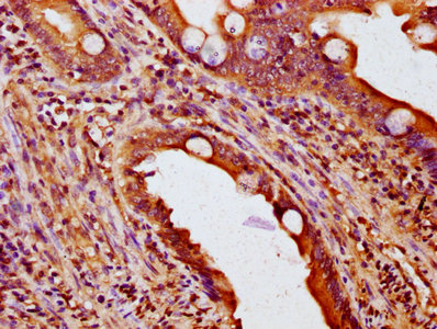 NOXO1 Antibody - Immunohistochemistry Dilution at 1:200 and staining in paraffin-embedded human small intestine tissue performed on a Leica BondTM system. After dewaxing and hydration, antigen retrieval was mediated by high pressure in a citrate buffer (pH 6.0). Section was blocked with 10% normal Goat serum 30min at RT. Then primary antibody (1% BSA) was incubated at 4°C overnight. The primary is detected by a biotinylated Secondary antibody and visualized using an HRP conjugated SP system.