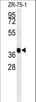 NPAL2 / NIPAL2 Antibody - NIPAL2 Antibody western blot of ZR-75-1 cell line lysates (35 ug/lane). The NIPAL2 antibody detected NIPAL2 protein (arrow).