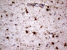NPAS1 Antibody - Immunohistochemical staining of paraffin-embedded Human embryonic brain cortex tissue within the normal limits using anti-NPAS1 mouse monoclonal antibody. (Heat-induced epitope retrieval by 1mM EDTA in 10mM Tris buffer. (pH8.5) at 120 oC for 3 min. (1:500)