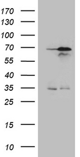 NPAS1 Antibody - HEK293T cells were transfected with the pCMV6-ENTRY control. (Left lane) or pCMV6-ENTRY NPAS1. (Right lane) cDNA for 48 hrs and lysed. Equivalent amounts of cell lysates. (5 ug per lane) were separated by SDS-PAGE and immunoblotted with anti-NPAS1. (1:500)