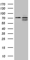 NPAS1 Antibody - HEK293T cells were transfected with the pCMV6-ENTRY control. (Left lane) or pCMV6-ENTRY NPAS1. (Right lane) cDNA for 48 hrs and lysed. Equivalent amounts of cell lysates. (5 ug per lane) were separated by SDS-PAGE and immunoblotted with anti-NPAS1. (1:2000)(1:1000)