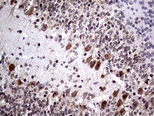 NPAS1 Antibody - Immunohistochemical staining of paraffin-embedded Human embryonic cerebellum within the normal limits using anti-NPAS1 mouse monoclonal antibody. (Heat-induced epitope retrieval by 1mM EDTA in 10mM Tris buffer. (pH8.5) at 120°C for 3 min. (1:500)