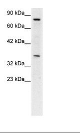 NPAS1 Antibody - Jurkat Cell Lysate.  This image was taken for the unconjugated form of this product. Other forms have not been tested.