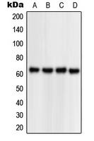 NPAS1 Antibody - Western blot analysis of NPAS1 expression in HEK293T (A); Jurkat (B); Raw264.7 (C); rat kidney (D) whole cell lysates.