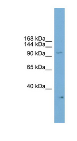 NPAS2 Antibody - NPAS2 antibody Western blot of Mouse Heart lysate. This image was taken for the unconjugated form of this product. Other forms have not been tested.