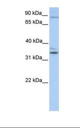 NPAS2 Antibody - Fetal heart lysate. Antibody concentration: 1.0 ug/ml. Gel concentration: 12%.  This image was taken for the unconjugated form of this product. Other forms have not been tested.