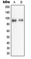 NPAS2 Antibody - Western blot analysis of NPAS2 expression in HeLa (A); HepG2 (B) whole cell lysates.