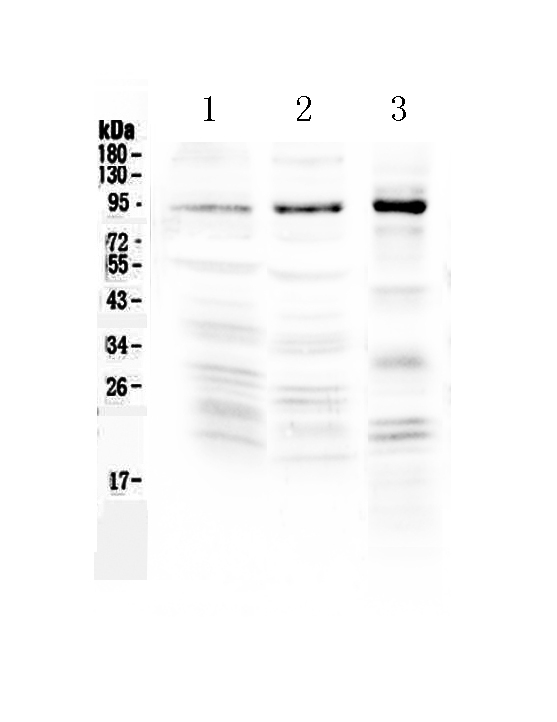 NPAS2 Antibody - Western blot analysis of NPAS2 using anti-NPAS2 antibody. Electrophoresis was performed on a 5-20% SDS-PAGE gel at 70V (Stacking gel) / 90V (Resolving gel) for 2-3 hours. The sample well of each lane was loaded with 50ug of sample under reducing conditions. Lane 1: rat brain tissue lysate,Lane 2: mouse brain tissue lysate,Lane 3: human COLO-320 whole cell lysate. After Electrophoresis, proteins were transferred to a Nitrocellulose membrane at 150mA for 50-90 minutes. Blocked the membrane with 5% Non-fat Milk/ TBS for 1.5 hour at RT. The membrane was incubated with rabbit anti-NPAS2 antigen affinity purified polyclonal antibody at 0.5 µg/mL overnight at 4°C, then washed with TBS-0.1% Tween 3 times with 5 minutes each and probed with a goat anti-rabbit IgG-HRP secondary antibody at a dilution of 1:10000 for 1.5 hour at RT. The signal is developed using an Enhanced Chemiluminescent detection (ECL) kit with Tanon 5200 system. A specific band was detected for NPAS2 at approximately 92KD. The expected band size for NPAS2 is at 92KD.