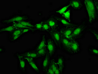 NPAS2 Antibody - Immunofluorescence staining of Hela cells at a dilution of 1:133, counter-stained with DAPI. The cells were fixed in 4% formaldehyde, permeabilized using 0.2% Triton X-100 and blocked in 10% normal Goat Serum. The cells were then incubated with the antibody overnight at 4°C.The secondary antibody was Alexa Fluor 488-congugated AffiniPure Goat Anti-Rabbit IgG (H+L) .