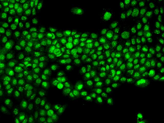 NPAS2 Antibody - Immunofluorescence staining of NPAS2 in A431 cells. Cells were fixed with 4% PFA, permeabilzed with 0.1% Triton X-100 in PBS, blocked with 10% serum, and incubated with rabbit anti-Human NPAS2 polyclonal antibody (dilution ratio 1:200) at 4°C overnight. Then cells were stained with the Alexa Fluor 488-conjugated Goat Anti-rabbit IgG secondary antibody (green). Positive staining was localized to Nucleus.