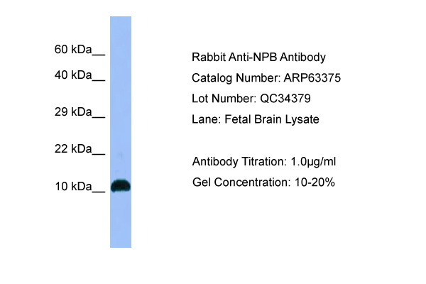 NPB Antibody -  This image was taken for the unconjugated form of this product. Other forms have not been tested.