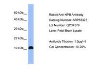 NPB Antibody -  This image was taken for the unconjugated form of this product. Other forms have not been tested.