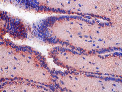 NPBWR1 / GPR7 Antibody - Clone 1F9 human hypothalamus paraffin section