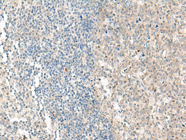 NPBWR1 / GPR7 Antibody - Immunohistochemistry of paraffin-embedded Human tonsil tissue  using NPBWR1 Polyclonal Antibody at dilution of 1:50(×200)