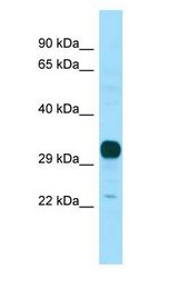 NPBWR1 / GPR7 Antibody - NPBWR1 / GPR7 antibody Western Blot of Fetal Brain.  This image was taken for the unconjugated form of this product. Other forms have not been tested.
