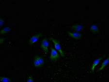 NPBWR2 / GPR8 Antibody - Immunofluorescent analysis of A549 cells using NPBWR2 Antibody at dilution of 1:100 and Alexa Fluor 488-congugated AffiniPure Goat Anti-Rabbit IgG(H+L)