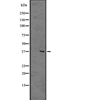 NPBWR2 / GPR8 Antibody - Western blot analysis of GPR8 antibody expression in human brain tissue lysates. The lane on the left is treated with the antigen-specific peptide.