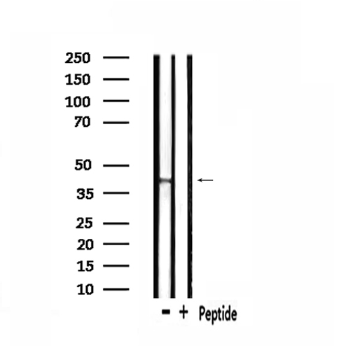 NPBWR2 / GPR8 Antibody - Western blot analysis of extracts of mouse brain tissue sample using GPR8 antibody.