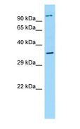 NPBWR2 / GPR8 Antibody - NPBWR2 / GPR8 antibody Western Blot of Placenta.  This image was taken for the unconjugated form of this product. Other forms have not been tested.