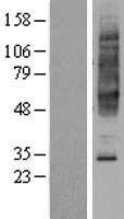 NPBWR2 / GPR8 Protein - Western validation with an anti-DDK antibody * L: Control HEK293 lysate R: Over-expression lysate