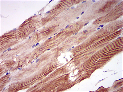 NPC / NPC1 Antibody - IHC of paraffin-embedded striated muscle tissues using NPC1 mouse monoclonal antibody with DAB staining.