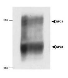 NPC / NPC1 Antibody - Detection of human NPC1 in 20 ug of human fibroblast cell lysate.  This image was taken for the unconjugated form of this product. Other forms have not been tested.