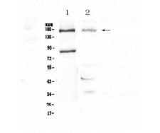 NPC / NPC1 Antibody - Western blot analysis of Niemann Pick C1 using anti-Niemann Pick C1 antibody