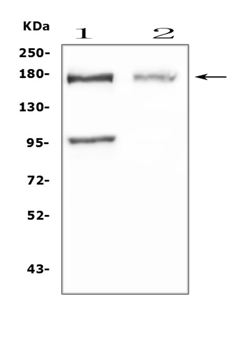 NPC / NPC1 Antibody - Western blot analysis of Niemann Pick C1 using anti-Niemann Pick C1 antibody. Electrophoresis was performed on a 5-20% SDS-PAGE gel at 70V (Stacking gel) / 90V (Resolving gel) for 2-3 hours. The sample well of each lane was loaded with 50ug of sample under reducing conditions. Lane 1: rat pancreas tissue lysates,Lane 2: mouse NIH3T3 whole cell lysates. After Electrophoresis, proteins were transferred to a Nitrocellulose membrane at 150mA for 50-90 minutes. Blocked the membrane with 5% Non-fat Milk/ TBS for 1.5 hour at RT. The membrane was incubated with rabbit anti-Niemann Pick C1 antigen affinity purified polyclonal antibody at 0.5 µg/mL overnight at 4°C, then washed with TBS-0.1% Tween 3 times with 5 minutes each and probed with a goat anti-rabbit IgG-HRP secondary antibody at a dilution of 1:10000 for 1.5 hour at RT. The signal is developed using an Enhanced Chemiluminescent detection (ECL) kit with Tanon 5200 system. A specific band was detected for Niemann Pick C1 at approximately 170KD. The expected band size for Niemann Pick C1 is at 142KD.