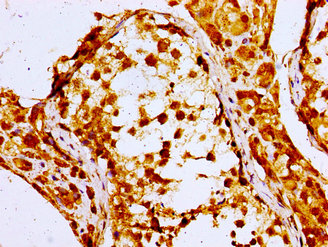 NPC / NPC1 Antibody - Immunohistochemistry image of paraffin-embedded human testis tissue at a dilution of 1:100
