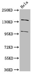 NPC / NPC1 Antibody - Positive Western Blot detected in Hela whole cell lysate. All lanes: NPC1 antibody at 3 µg/ml Secondary Goat polyclonal to rabbit IgG at 1/50000 dilution. Predicted band size: 143, 108 KDa. Observed band size: 143, 108 KDa