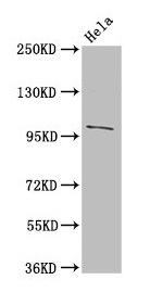 NPC / NPC1 Antibody - Western Blot Positive WB detected in: Hela whole cell lysate All lanes: NPC1 antibody at 3µg/ml Secondary Goat polyclonal to rabbit IgG at 1/50000 dilution Predicted band size: 143, 108 kDa Observed band size: 108 kDa