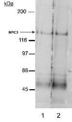 NPC1L1 Antibody - Detection of NPC3 in rat small intestine membrane preparations (20 ug). Lane 1: 2 ug/ml. Lane 2: 4 ug/ml. ECL: 5 minute exposure.  This image was taken for the unconjugated form of this product. Other forms have not been tested.