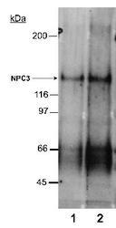 NPC1L1 Antibody - Detection of NPC3 in rat small intestine membrane preparations (20 ug). Lane 1: 2 ug/ml. Lane 2: 4 ug/ml. ECL: 30 minute exposure.  This image was taken for the unconjugated form of this product. Other forms have not been tested.