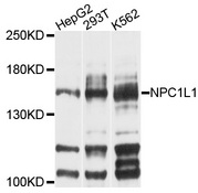 NPC1L1 Antibody - Western blot analysis of extracts of various cell lines, using NPC1L1 antibody at 1:1000 dilution. The secondary antibody used was an HRP Goat Anti-Rabbit IgG (H+L) at 1:10000 dilution. Lysates were loaded 25ug per lane and 3% nonfat dry milk in TBST was used for blocking. An ECL Kit was used for detection and the exposure time was 15s.