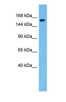 NPC1L1 Antibody - Western blot of NPCL1 Antibody with human Fetal Liver lysate.  This image was taken for the unconjugated form of this product. Other forms have not been tested.