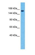 NPC1L1 Antibody - Western blot of NPCL1 Antibody with human Fetal Liver lysate.  This image was taken for the unconjugated form of this product. Other forms have not been tested.