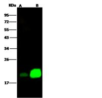 NPC2 Antibody - Anti-NPC2 rabbit monoclonal antibody at 1:500 dilution. Lane A: Hela Whole Cell Lysate. Lane B: NIH-3T3 Whole Cell Lysate. Lysates/proteins at 30 ug per lane. Secondary: Goat Anti-Rabbit IgG H&L (Dylight800) at 1/10000 dilution. Developed using the Odyssey technique. Performed under reducing conditions. Predicted band size: 17 kDa. Observed band size: 19 kDa.